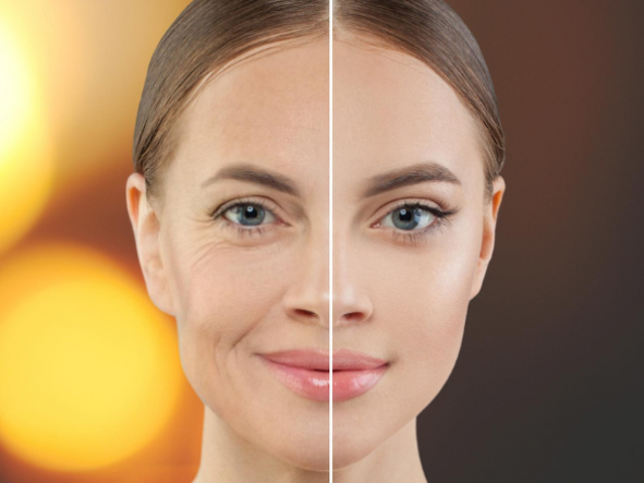 Inflammaging - A New Way to Look At Skin Aging